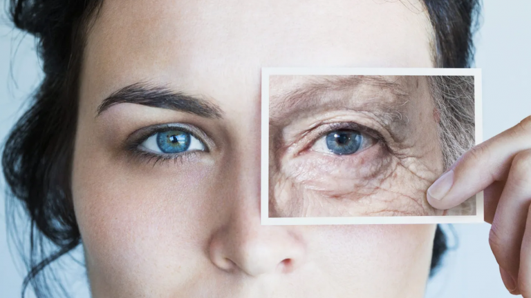 Aging: An In-Depth Exploration